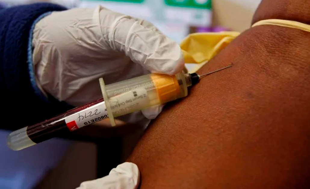 ¿Qué es la fiebre de Lassa, la epidemia que afecta a Nigeria?