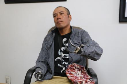 DIF estatal entrega prótesis a joven que perdió sus manos durante un asalto