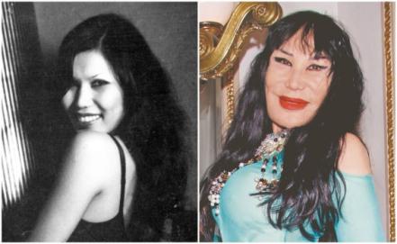 Así ha cambiado el rostro de estas famosas después de las cirugías y el bótox