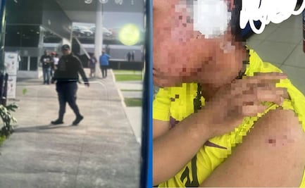 Guardias de seguridad agreden con pistola de balines a persona discapacitada en plaza comercial de SLP