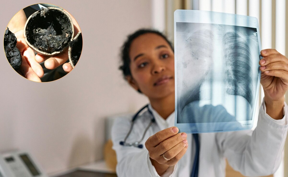 Cuatecomate, la planta medicinal que cura las enfermedades respiratorias