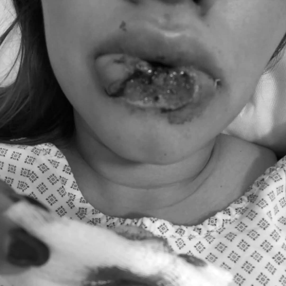 Katia Berenice estuvo a punto de perder el labio tras la agresión de su expareja