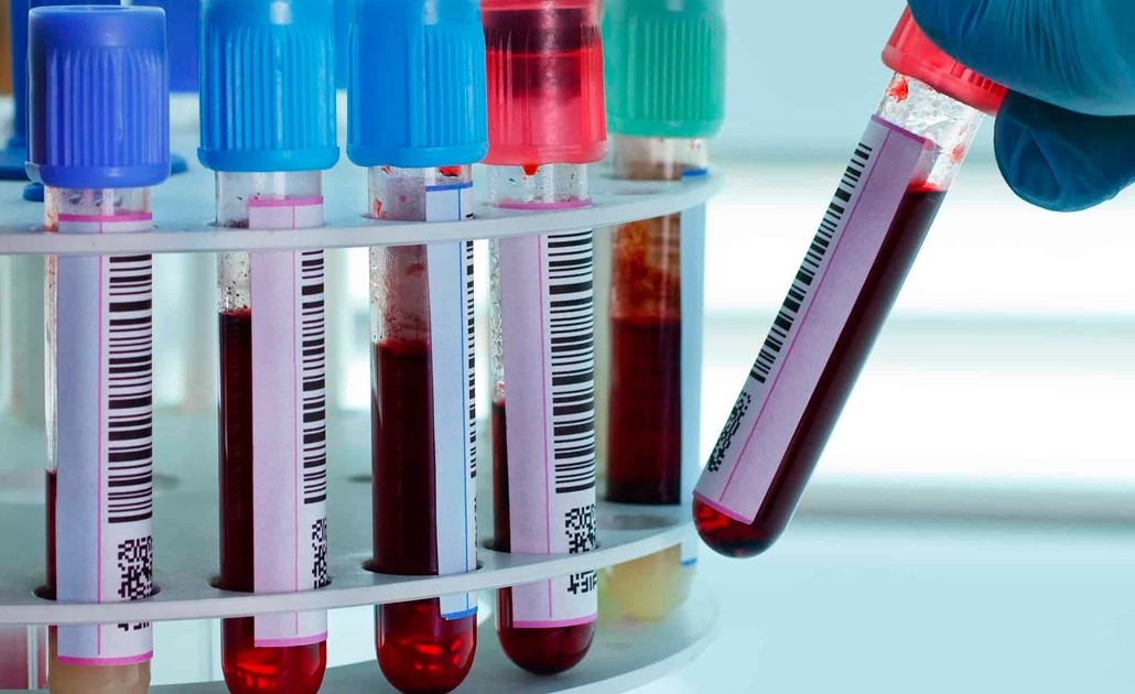 Perfecciona IPICYT método para detectar candidemia