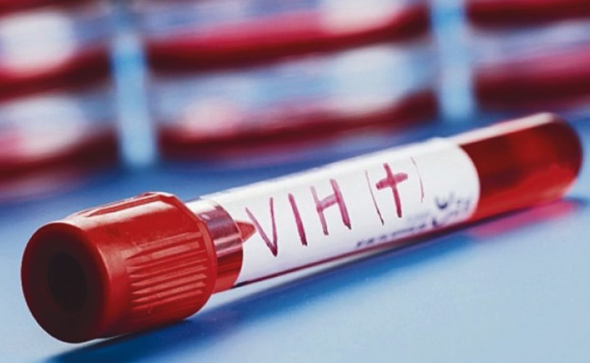 Al año se detectan en promedio 320 casos de VIH en SLP: Salud estatal