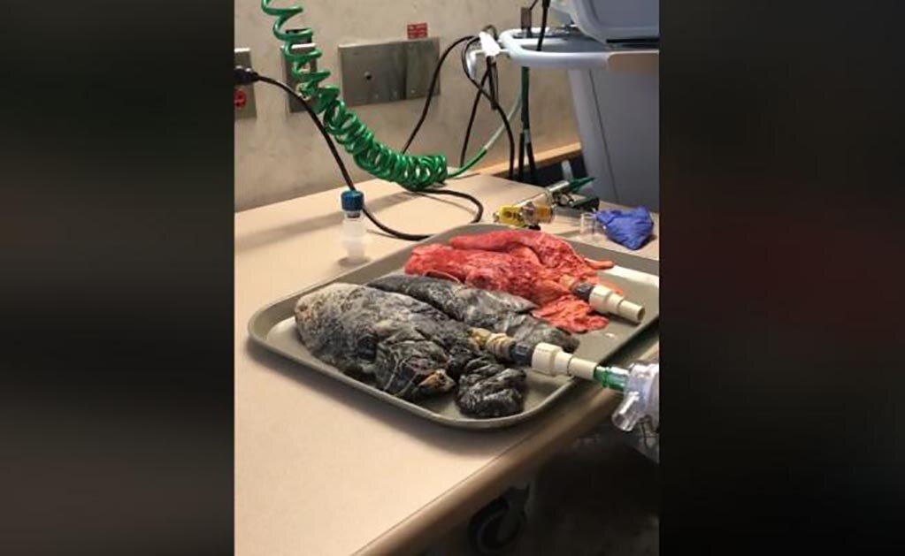 De acuerdo con expertos, fumar aumenta 23 veces el riesgo de una persona de desarrollar cáncer de pulmón. (FOTO: Tomada de Facebook)