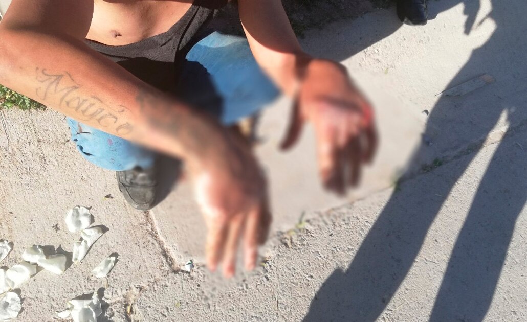 Le queman las manos a presunto ladrón