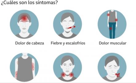 Viruela del mono: Cinco claves para comprender la infección