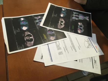 Laura necesita un trasplante de médula en 20 días para vencer el cáncer; solicita apoyo en SLP