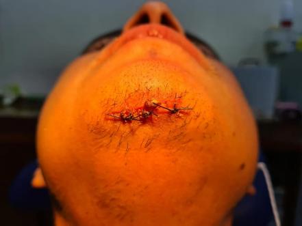 Acusan a policías municipales de Soledad de presunta agresión contra ciclista en SLP