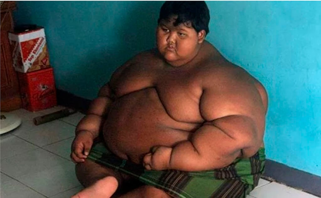Así luce ahora “el niño más gordo del mundo”