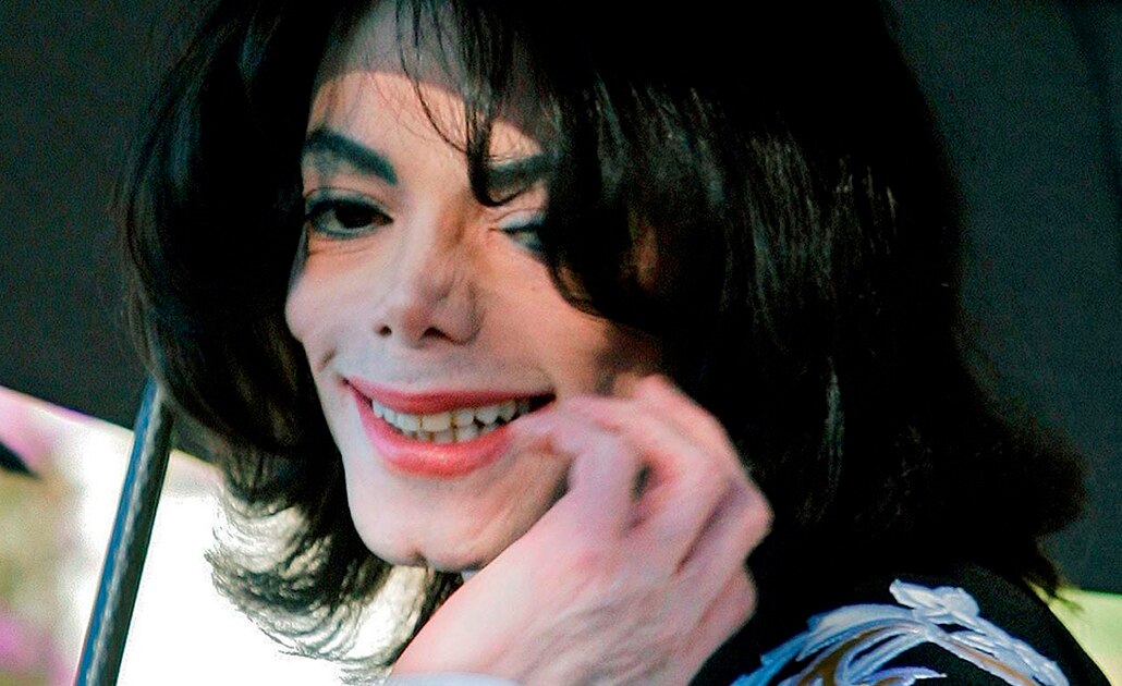Michael Jackson murió calvo y con cicatrices en el cuerpo