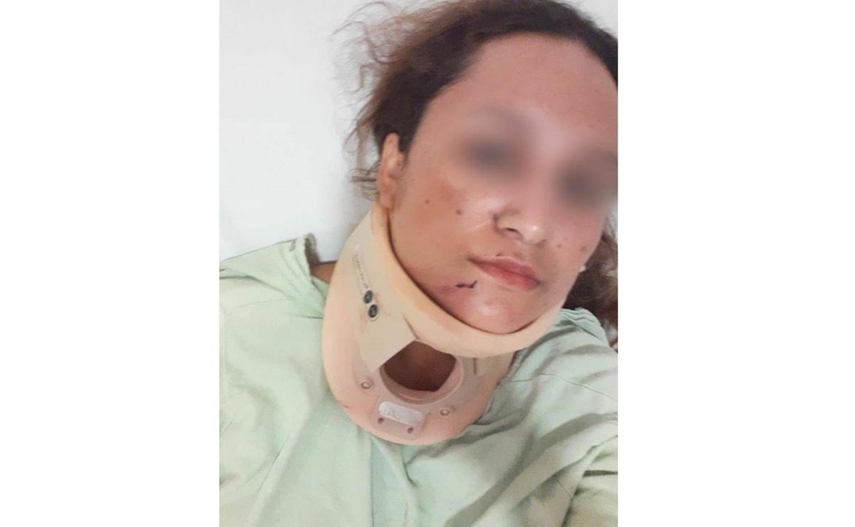 Anciano ataca a candidata del PAN en Tamasopo