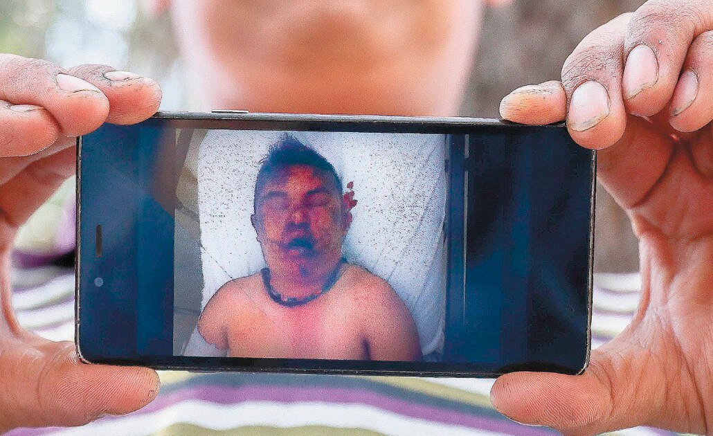 Las lesiones provocadas por el linchamiento hicieron que José Modesto Gonzá lez fuera entubado y entrara en coma; a la fecha, no hay ningún detenido. DIEGO SIMÓN. EL UNIVERSAL