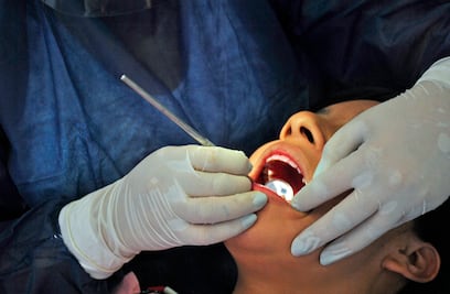 20% de los niños en SLP tienen problemas de caries