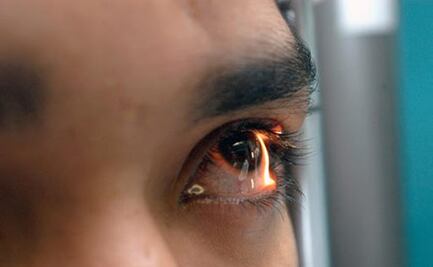 ¿Cómo cuidar tus ojos durante el home office?