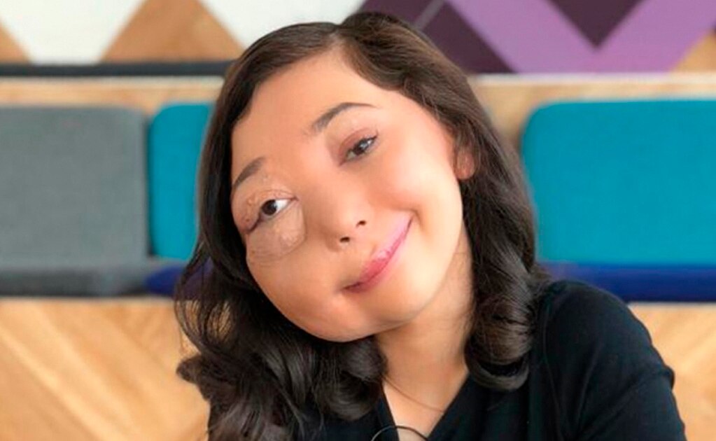 La youtuber con una malformación que será premiada en los BAFTA