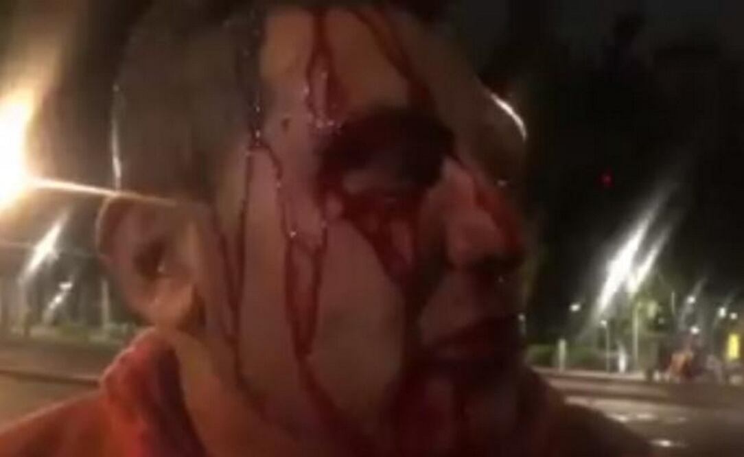 Foto: periodista golpeado en la Doctores. (tomada del video: Cortesía Isidro Corro)