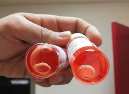 Hospital General de Valles cerraría con novena donación de órganos