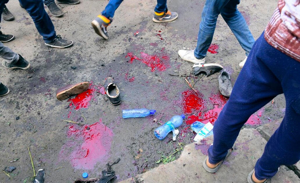 Atentado contra premier de Etiopía deja un muerto y más de 150 heridos