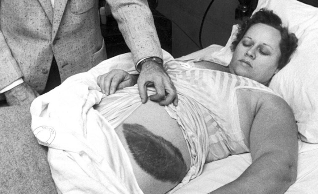 Ella es Ann Hodges, la única persona que ha sido golpeada por un meteorito