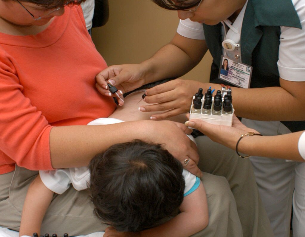 IMSS invita a prever alergias en semana santa