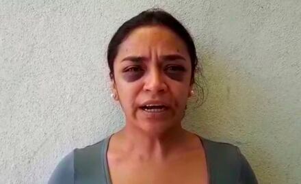 Periodista acusa golpiza de policías al denunciar intento de violación en Morelia