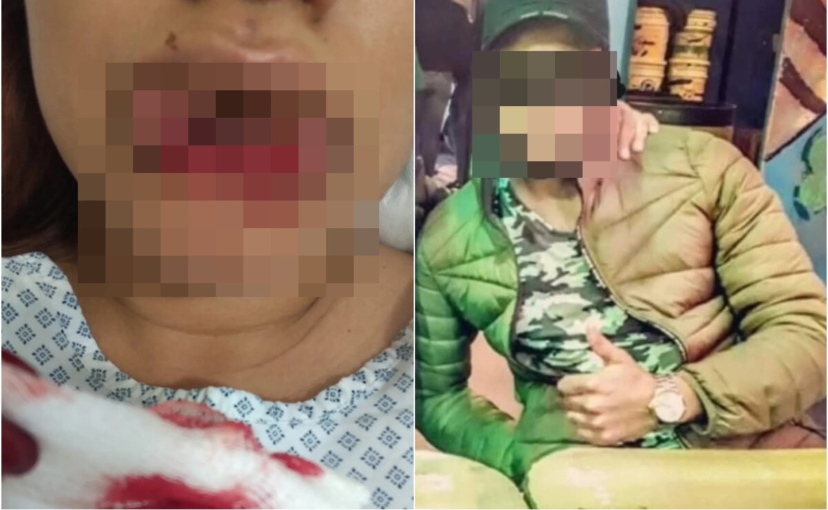 Tras ser brutalmente agredida, joven denuncia que juez puso en libertad a su agresor en SLP 