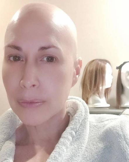 Martha Guzmán se muestra sin cabello por lucha contra el cáncer