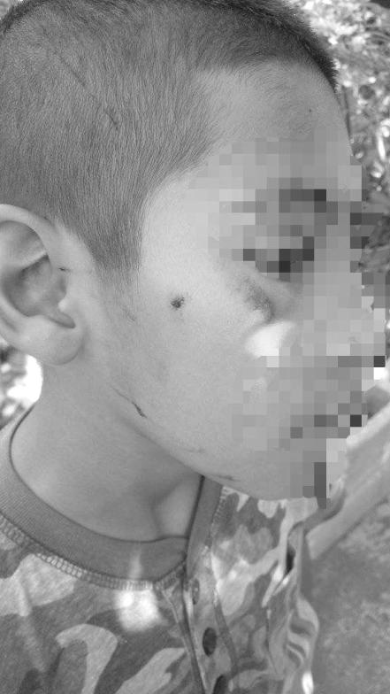 Insultos y agresiones físicas: madre denuncia bullying contra su hijo en primaria del Altiplano