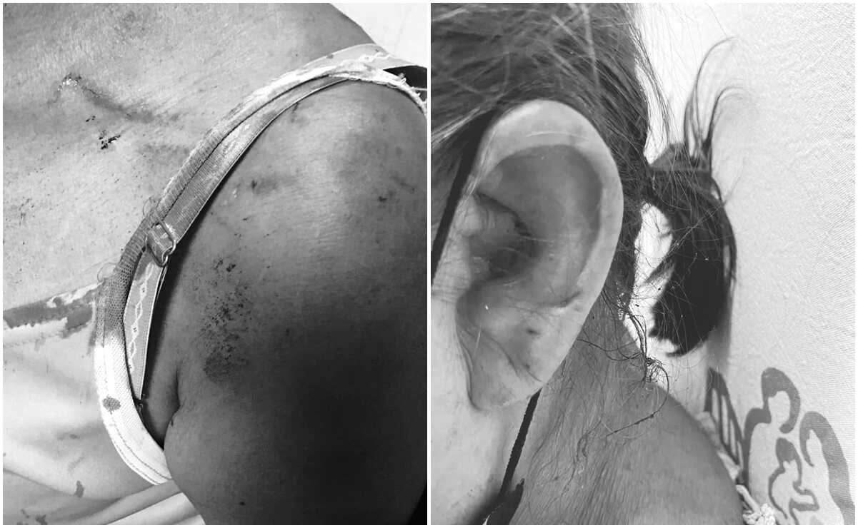 Paciente con esquizofrenia abusó sexualmente de mujer en hospital del ISSSTE, denuncian familiares  