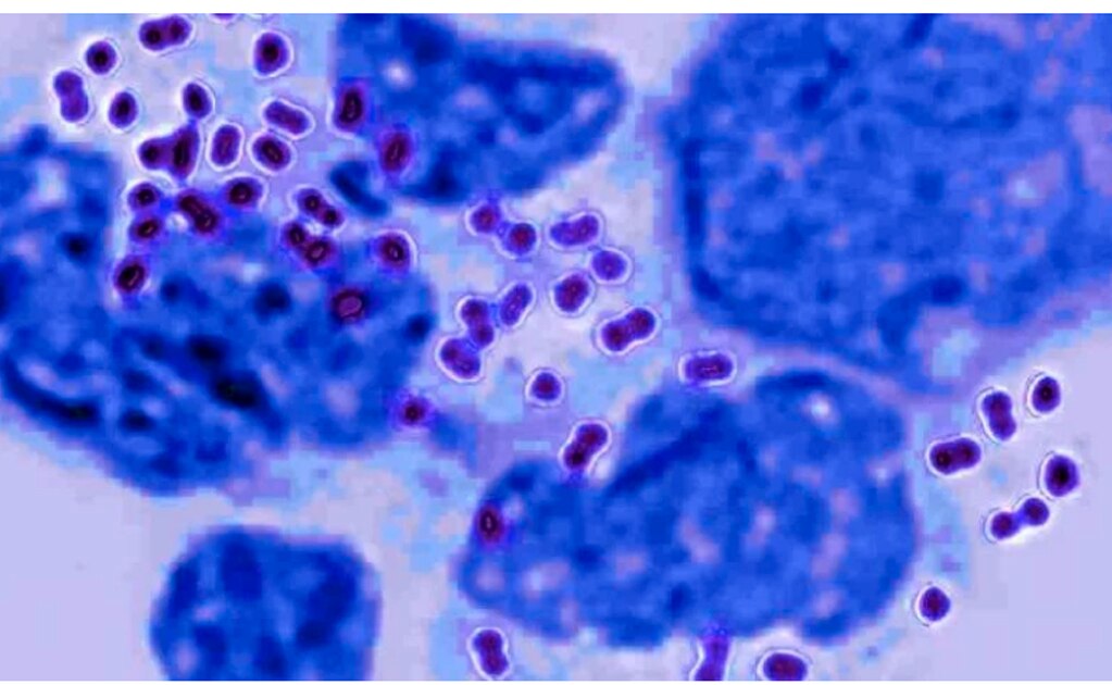 La gonorrea es una de las infecciones de transmisión sexual más comunes en el mundo. (Foto: Especial)