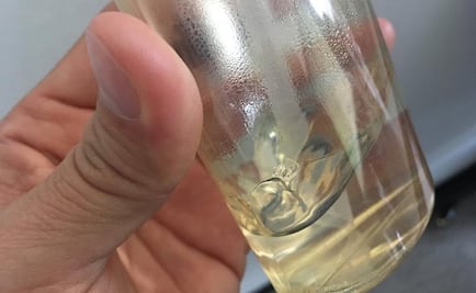 Salud en SLP alerta por riesgo de adquirir gel antibacterial con metanol