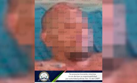 Fue al hospital por quemaduras, lo detienen por intentar matar a su rival