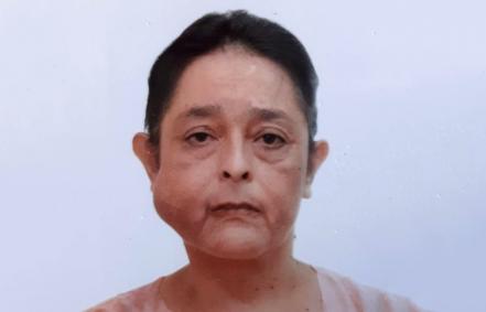 Doña Rosa ha vuelto a sonreír luego de extirparle un tumor de la mejilla