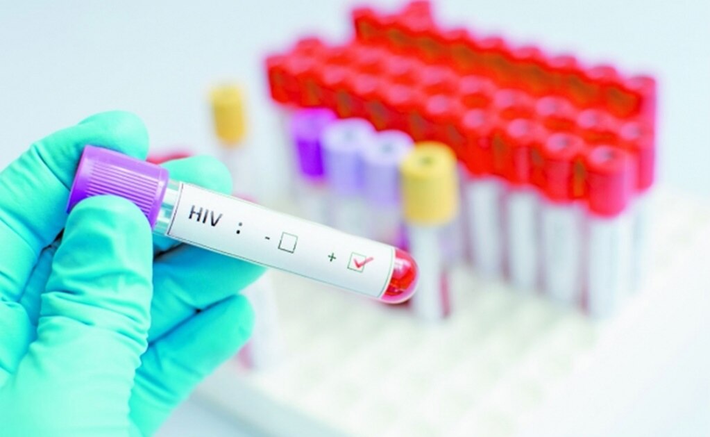 Paciente con VIH se cura gracias a trasplante de células madre