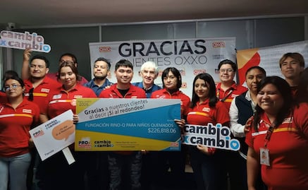 De 7 mil a 18 mil pesos; alto costo de Visas frena atención médica gratuita en EU para niños con quemaduras