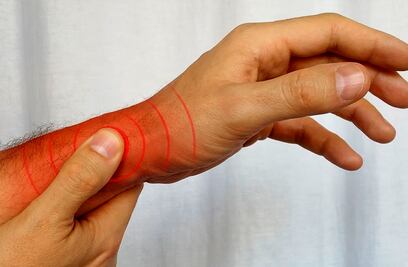 Tenosinovitis de Quervain, la enfermedad por el uso excesivo del celular