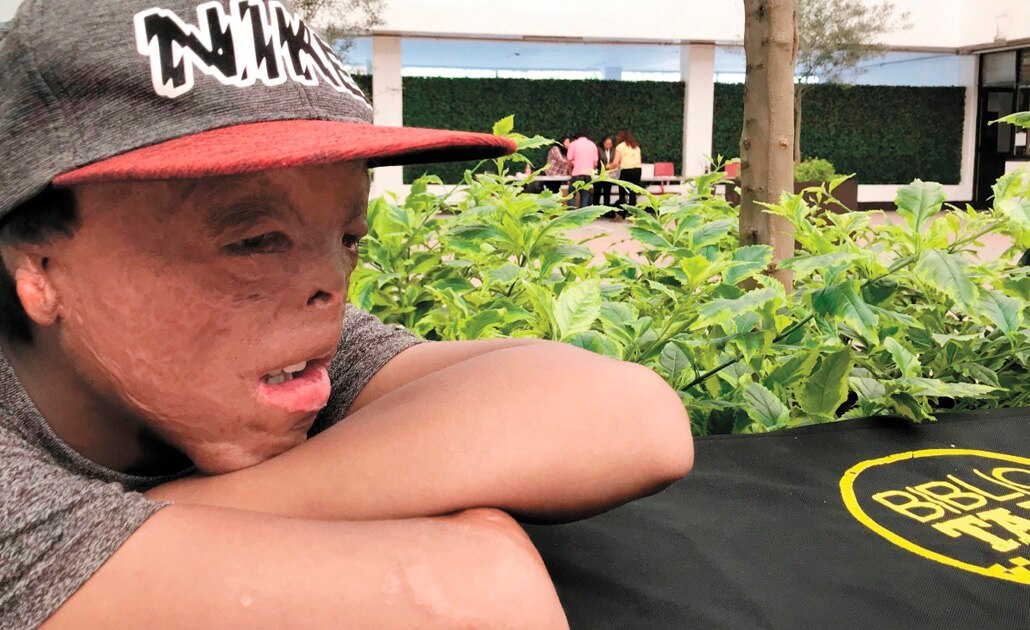 Juan lucha por recuperar lo que el fuego le quitó de bebé