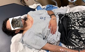 "Logan Montana" resulta lesionado durante función de lucha libre en SLP; acusan presunta negligencia