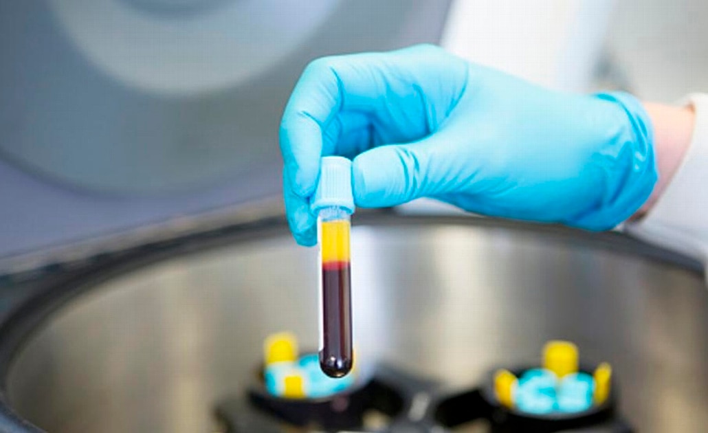 Toshiba crea sistema para detectar cáncer