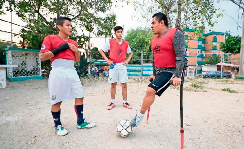 “Tengo que aceptarme como soy”; la historia del segundo niño del Teletón