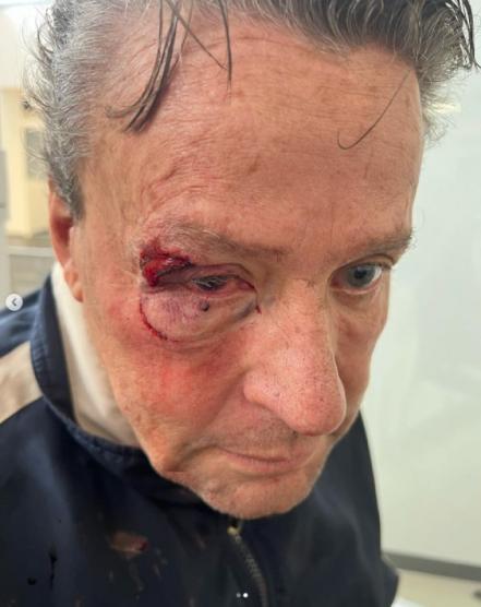 Golpean a Alfredo Adame por intentar grabar a dos personas baleadas en CDMX; hay dos detenidos