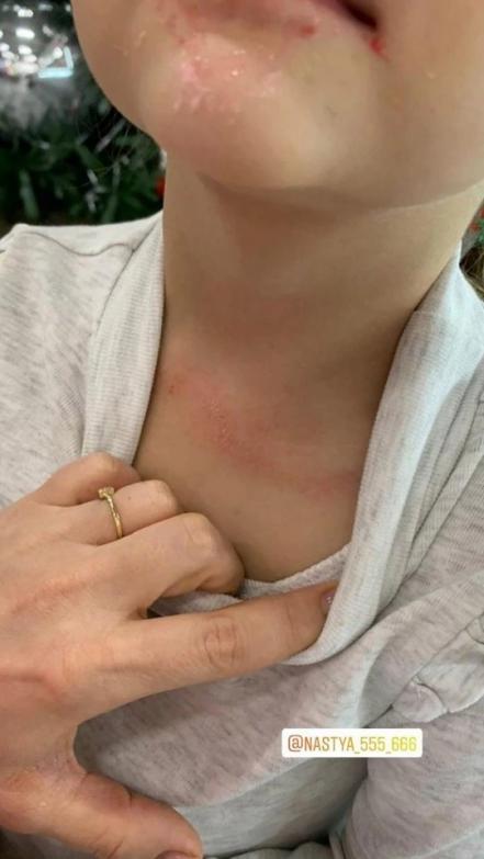 Niña de 3 años estuvo a punto de morir ahorcada en resbaladilla