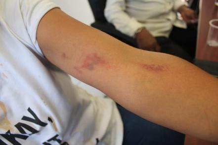 Condena CEDH actuación de policías municipales en desalojo de comerciantes