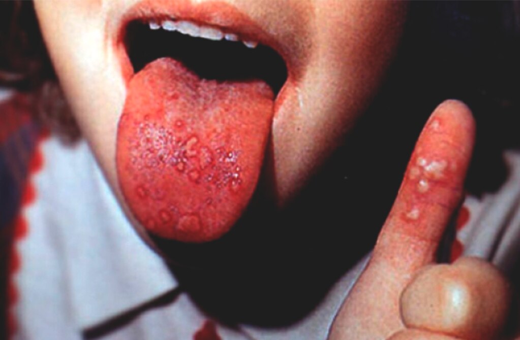 Foto: Archivo. El Universal.