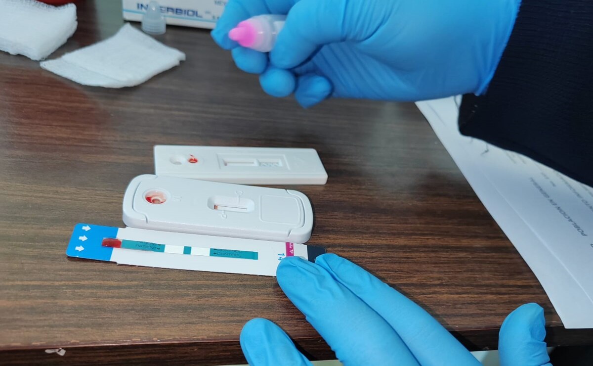 Diagnósticos para detectar sida en SLP¨. Foto: Especial