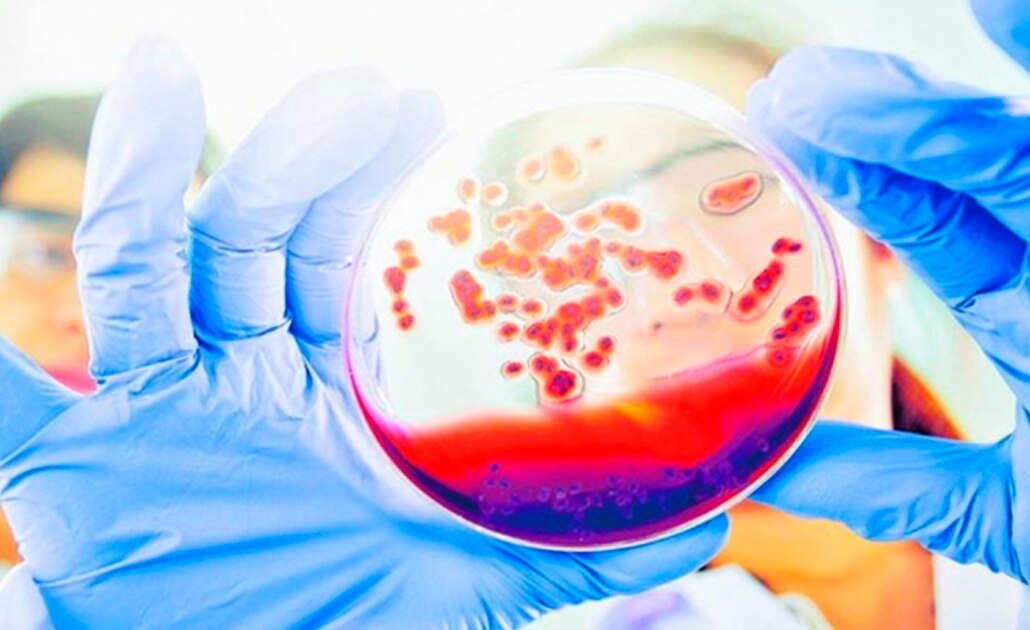 Alertan sobre presunto reto viral que propaga contagio de VIH/Sida