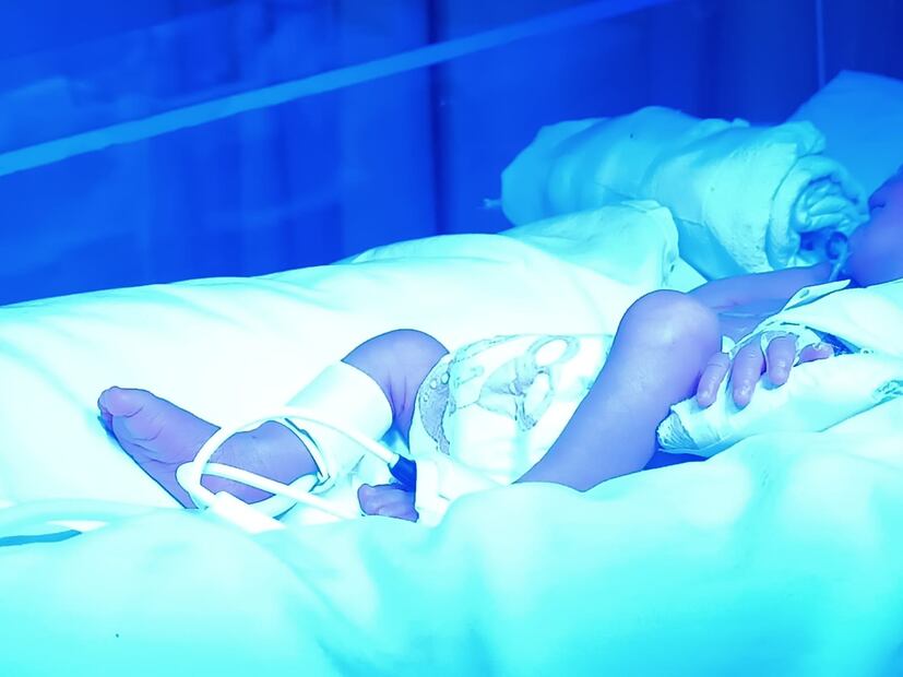 Isabela, la bebé de 800 gramos más pequeña del Hospital Central de SLP