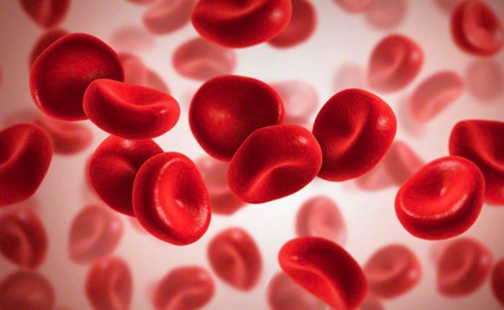 ¿Qué es la trombosis cerebral relacionada con la vacuna AstraZeneca?