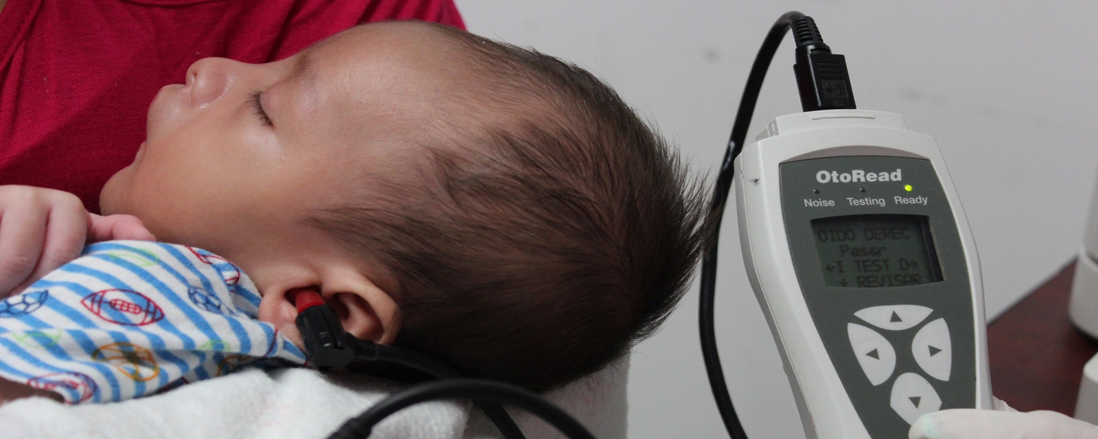 Sordera en nacidos puede tratarse adecuadamente a través de tamiz